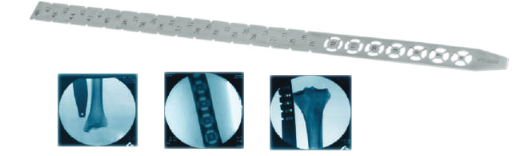 RADIOGRAPHY SCALE RADIOGRAPHY SCALE